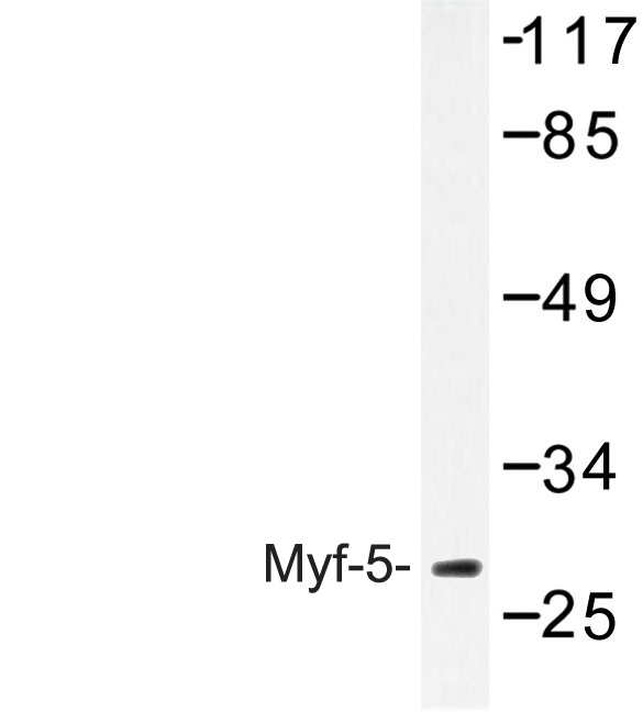 Western blot of Myf-5 (A88) pAb in extracts from HepG2 cells.