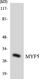 Western blot of the lysates from K562 cells using MYF5 antibody.