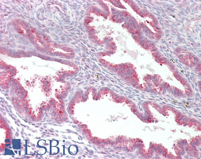 Anti-MYF5 / MYF 5 antibody IHC staining of human uterus. Immunohistochemistry of formalin-fixed, paraffin-embedded tissue after heat-induced antigen retrieval.