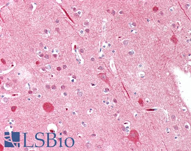 Anti-MYF5 / MYF 5 antibody IHC staining of human brain, cortex. Immunohistochemistry of formalin-fixed, paraffin-embedded tissue after heat-induced antigen retrieval. Antibody LS-B10723 dilution 1:75.