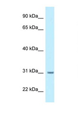 BPHL antibody LS-C145937 Western blot of 1 Cell lysate. Antibody concentration 1 ug/ml.