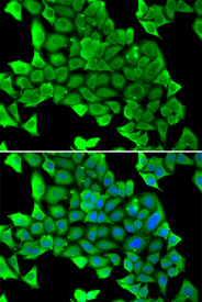 Immunofluorescence blot of U20S cell using MYH1 antibody. Blue: DAPI for nuclear staining.