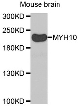 Western blot analysis of extracts of Mouse brain tissue, using MYH10 antibody.