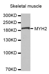 Western blot analysis of extracts of Skeletal muscle cell line, using MYH2 antibody.