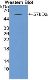 Western blot of recombinant MYH2.