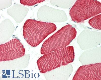 Human Skeletal Muscle: Formalin-Fixed, Paraffin-Embedded (FFPE)