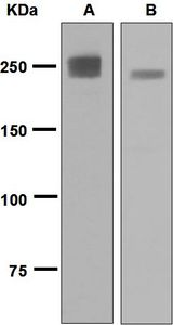 Western blot analysis on (A) mouse muscle and (B) rat muscle lysates using anti-Myosin Heavy Chain 2 antibody.