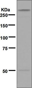 Western blot analysis on human trachea lysate using anti-Myosin Heavy Chain 2 antibody.
