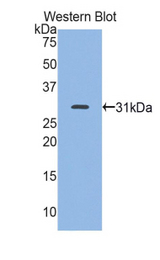 Western blot of recombinant MYH7.