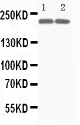 WB of MYH7 antibody. All lanes: Anti-Myosin(slow) at 0.5ug/ml. Lane 1: Rat Skeletal Muscle Tissue Lysate at 40ug. Lane 2: Mouse Skeletal Muscle Tissue Lysate at 40ug. Predicted bind size: 200KD. Observed bind size: 200KD.