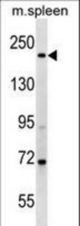 MYH7 Antibody western blot of mouse spleen tissue lysates (35 ug/lane). The MYH7 antibody detected the MYH7 protein (arrow).