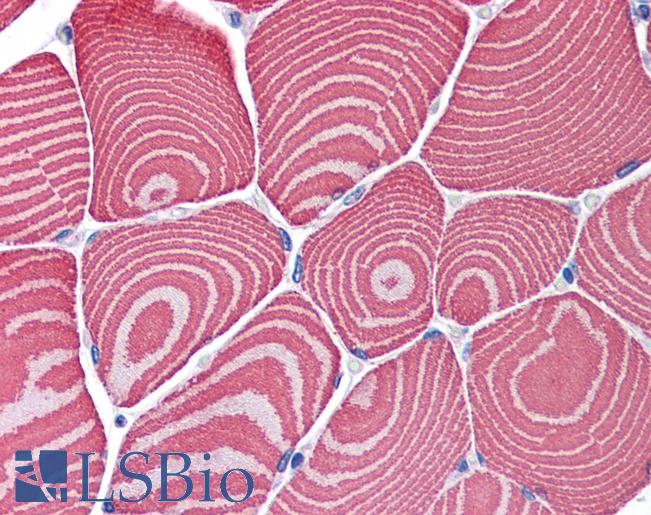 Anti-MYH7 antibody IHC of human skeletal muscle. Immunohistochemistry of formalin-fixed, paraffin-embedded tissue after heat-induced antigen retrieval. Antibody LS-B5888 concentration 2.5 ug/ml.