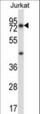 MCOLN1 Antibody western blot of Jurkat cell line lysates (35 ug/lane). The MCOLN1 antibody detected the MCOLN1 protein (arrow).