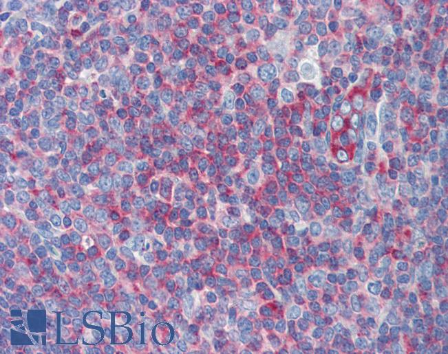 Anti-MYH9 antibody IHC of human tonsil. Immunohistochemistry of formalin-fixed, paraffin-embedded tissue after heat-induced antigen retrieval. Antibody LS-B5806 concentration 5 ug/ml.