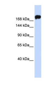 MYH9 antibody LS-B5806 Western blot of MCF7 cell lysate.