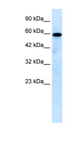 MCOLN1 / Mucolipin 1 antibody LS-B159 Western blot of Jurkat lysate.
