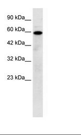 Jurkat Cell Lysate