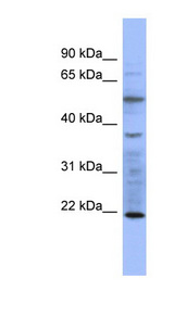 MYL3 antibody LS-C107502 Western blot of COLO205 cell lysate.