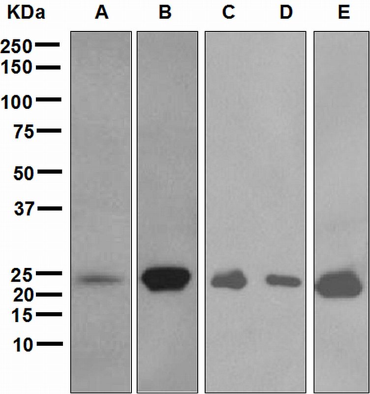 Western blot analysis on (A) human skeletal muscle, (B) human heart, (C) mouse heart, (D) mouse liver, and (E) rat heart lysates using anti-Myosin Light Chain 3 antibody.