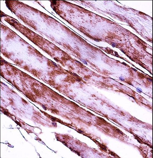 MYL3 Antibody immunohistochemistry of formalin-fixed and paraffin-embedded human skeletal muscle followed by peroxidase-conjugated secondary antibody and DAB staining.
