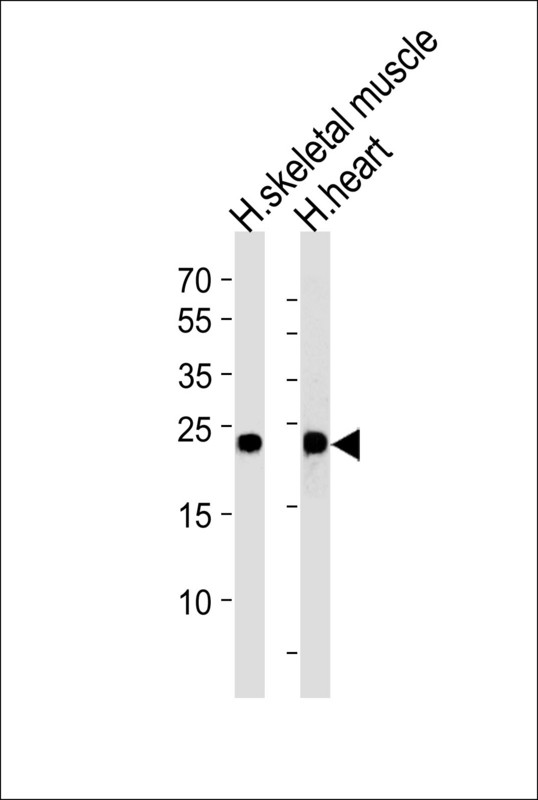 Western blot of lysates from human skeletal muscle and heart tissue lysates (from left to right), using MYL3 Antibody. Antibody was diluted at 1:1000 at each lane. A goat anti-rabbit IgG H&L (HRP) at 1:5000 dilution was used as the secondary antibody. Lysates at 35ug per lane.