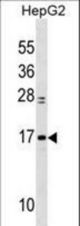 MYL6 Antibody western blot of HepG2 cell line lysates (35 ug/lane). The MYL6 Antibody detected the MYL6 protein (arrow).