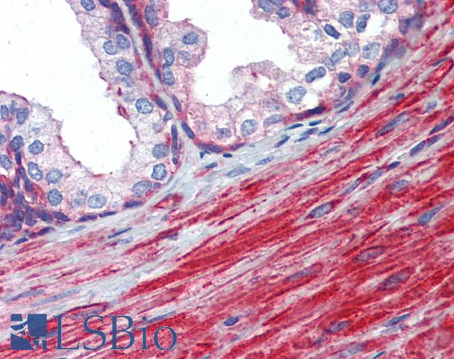 Anti-MYL6 antibody IHC of human prostate. Immunohistochemistry of formalin-fixed, paraffin-embedded tissue after heat-induced antigen retrieval. Antibody LS-B4025 concentration 5 ug/ml.