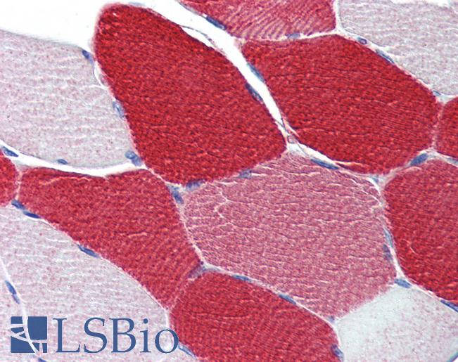 Anti-MYL6 antibody IHC of human skeletal muscle. Immunohistochemistry of formalin-fixed, paraffin-embedded tissue after heat-induced antigen retrieval. Antibody LS-B4025 concentration 5 ug/ml.