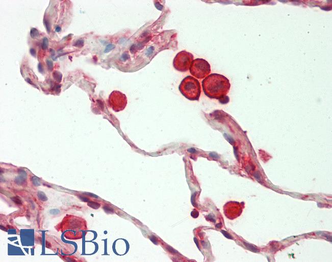 Human Lung: Formalin-Fixed, Paraffin-Embedded (FFPE)