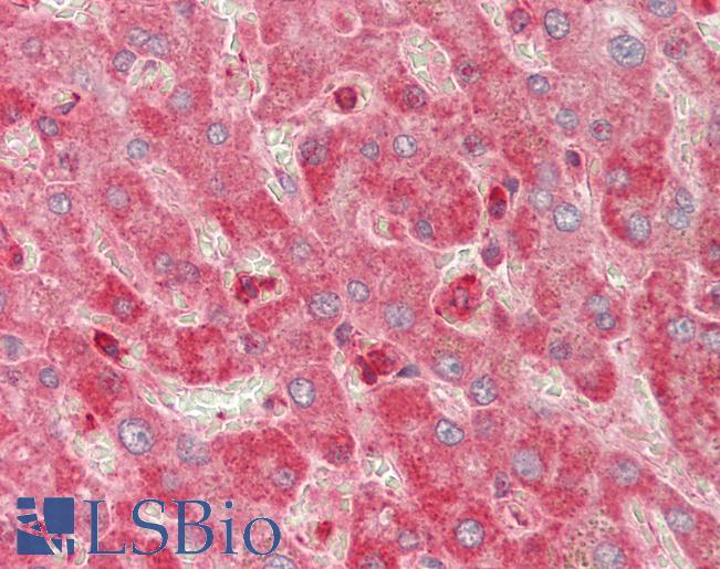 Human Liver: Formalin-Fixed, Paraffin-Embedded (FFPE)