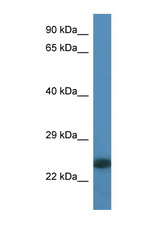 MYL6B antibody LS-C135262 Western blot of Rat Liver lysate. Antibody concentration 1 ug/ml.
