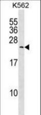 MYL6B Antibody western blot of K562 cell line lysates (35 ug/lane). The MYL6B antibody detected the MYL6B protein (arrow).