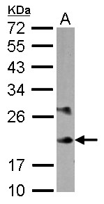Sample (30 ug of whole cell lysate) A: K562 12% SDS PAGE MYL6B antibody diluted at 1:10000
