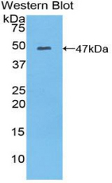 Western blot of recombinant MYL6B.