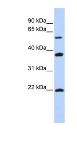 MYLIP antibody LS-C110763 Western blot of SK-MEL-2 cell lysate.