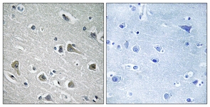 IHC of paraffin-embedded human brain tissue, using MYLIP Antibody. The picture on the right is treated with the synthesized peptide.