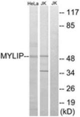 Western blot of extracts from HeLa/Jurkat cells, using MYLIP Antibody. The lane on the right is treated with the synthesized peptide.
