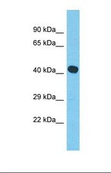 Western blot of Human RPMI-8226. MYLK4 antibody dilution 1.0 ug/ml.