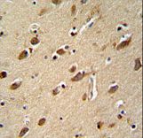 MYLK4 antibody immunohistochemistry of formalin-fixed and paraffin-embedded human brain tissue followed by peroxidase-conjugated secondary antibody and DAB staining.