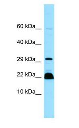 MYLPF antibody Western Blot of Jurkat.