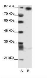 A: Marker, B: HepG2 Cell Lysate