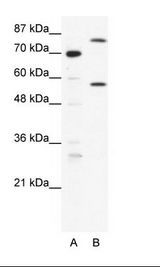 A: Marker, B: HepG2 Cell Lysate