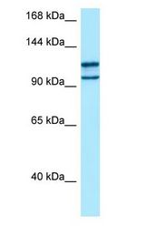 MYO10 / Myosin-X antibody Western Blot of 293T.