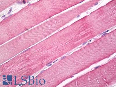 Anti-MYO10 / MYOSIN-X antibody IHC of human skeletal muscle. Immunohistochemistry of formalin-fixed, paraffin-embedded tissue after heat-induced antigen retrieval. Antibody LS-B8137 dilution 5 ug/ml.