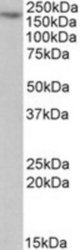 MYO5A antibody (1 ug/ml) staining of Jurkat lysate (35 ug protein/ml in RIPA buffer). Primary incubation was 1 hour. Detected by chemiluminescence.