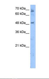 Jurkat cell lysate. Antibody concentration: 5.0 ug/ml. Gel concentration: 12%.