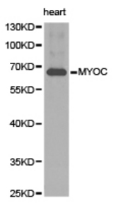 Western blot of extracts of human heart tissue, using MYOC antibody.