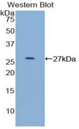 Western blot of recombinant MYOC / Myocilin.