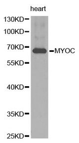 Western blot analysis of extracts of human heart tissue, using MYOC antibody.