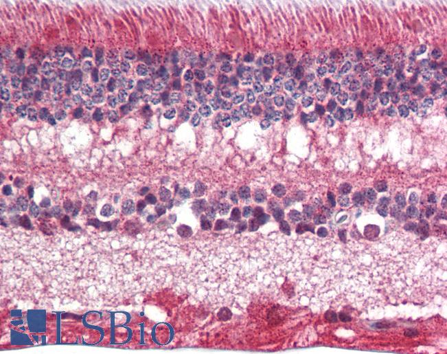 Anti-MYOC antibody IHC of human eye, retina. Immunohistochemistry of formalin-fixed, paraffin-embedded tissue after heat-induced antigen retrieval. Antibody LS-B2262 concentration 5 ug/ml.